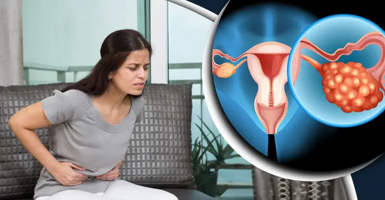 ovary-20230508141723-1 (1)